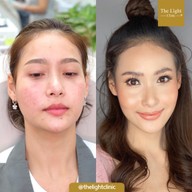 เมนูของร้าน The Light Clinic เดอะไลท์คลินิก