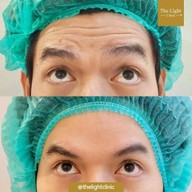 เมนูของร้าน The Light Clinic เดอะไลท์คลินิก