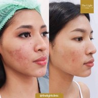 เมนูของร้าน The Light Clinic เดอะไลท์คลินิก