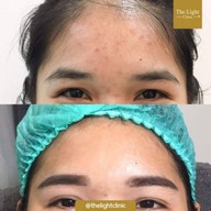 เมนูของร้าน The Light Clinic เดอะไลท์คลินิก