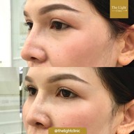 เมนูของร้าน The Light Clinic เดอะไลท์คลินิก