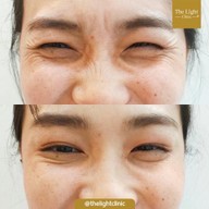 เมนูของร้าน The Light Clinic เดอะไลท์คลินิก