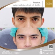 เมนูของร้าน The Light Clinic เดอะไลท์คลินิก
