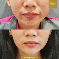 เมนูของร้าน The Light Clinic เดอะไลท์คลินิก