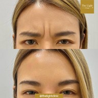 เมนูของร้าน The Light Clinic เดอะไลท์คลินิก