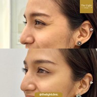 เมนูของร้าน The Light Clinic เดอะไลท์คลินิก