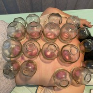 ศรีริกุลคลินิกแพทย์แผนจีน ฝังเข็ม ครอบแก้ว ยาจีน พิษณุโลก