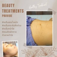 ศรีริกุลคลินิกแพทย์แผนจีน ฝังเข็ม ครอบแก้ว ยาจีน พิษณุโลก