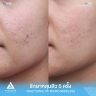 เมนูของร้าน Attitude Clinic  ห้วยขวาง