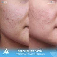เมนูของร้าน Attitude Clinic  ห้วยขวาง