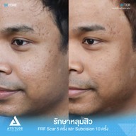 เมนูของร้าน Attitude Clinic  ห้วยขวาง