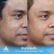 เมนูของร้าน Attitude Clinic  ห้วยขวาง