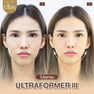 Glam clinic แม่กลอง