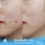 เมนูของร้าน ATTITUDE CLINIC เชียงใหม่