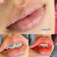 สักคิ้วสักปากท่าซักนครศรีธรรมราช Byดาร์ ท่าซัก