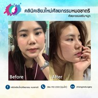 เชียงใหม่ศัลยกรรม