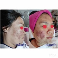 Always Clinic ยโสธร ยโสธร