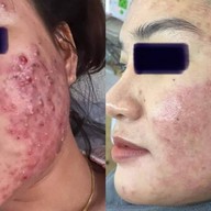 Always Clinic ยโสธร ยโสธร