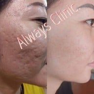 Always Clinic ยโสธร ยโสธร