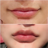 เมนูของร้าน The Scene Clinic - เดอะซีน คลินิก  บางนา