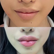 เมนูของร้าน The Scene Clinic - เดอะซีน คลินิก  บางนา