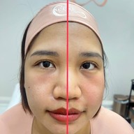 เมนูของร้าน The Scene Clinic - เดอะซีน คลินิก  บางนา