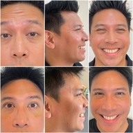 เมนูของร้าน The Scene Clinic - เดอะซีน คลินิก  บางนา