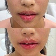 เมนูของร้าน The Scene Clinic - เดอะซีน คลินิก  บางนา