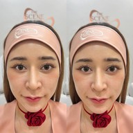 เมนูของร้าน The Scene Clinic - เดอะซีน คลินิก  บางนา