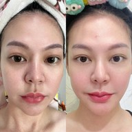 เมนูของร้าน The Scene Clinic - เดอะซีน คลินิก  บางนา