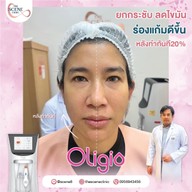 เมนู The Scene Clinic - เดอะซีน คลินิก  บางนา