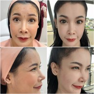 เมนูของร้าน The Scene Clinic - เดอะซีน คลินิก  บางนา