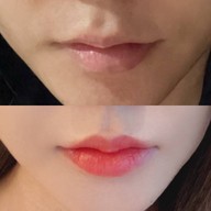 เมนูของร้าน The Scene Clinic - เดอะซีน คลินิก  บางนา