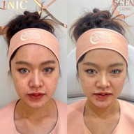 เมนูของร้าน The Scene Clinic - เดอะซีน คลินิก  บางนา