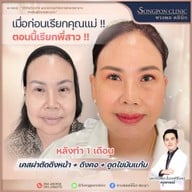 ทรงพลคลินิก โดย คุณหมอทอมมี่