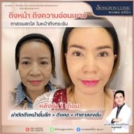 ทรงพลคลินิก โดย คุณหมอทอมมี่