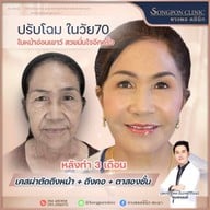 ทรงพลคลินิก โดย คุณหมอทอมมี่