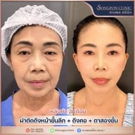 ทรงพลคลินิก โดย คุณหมอทอมมี่