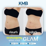 KMB Hospital โรงพยาบาลเฉพาะทาง คุณหมอลูกหนู