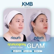 KMB Hospital โรงพยาบาลเฉพาะทาง คุณหมอลูกหนู
