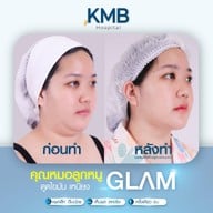 KMB Hospital โรงพยาบาลเฉพาะทาง คุณหมอลูกหนู