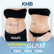 KMB Hospital โรงพยาบาลเฉพาะทาง คุณหมอลูกหนู