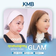 KMB Hospital โรงพยาบาลเฉพาะทาง คุณหมอลูกหนู