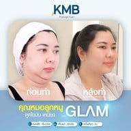 KMB Hospital โรงพยาบาลเฉพาะทาง คุณหมอลูกหนู