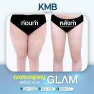 KMB Hospital โรงพยาบาลเฉพาะทาง คุณหมอลูกหนู