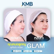 KMB Hospital โรงพยาบาลเฉพาะทาง คุณหมอลูกหนู