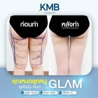 KMB Hospital โรงพยาบาลเฉพาะทาง คุณหมอลูกหนู