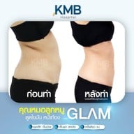 KMB Hospital โรงพยาบาลเฉพาะทาง คุณหมอลูกหนู