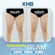 KMB Hospital โรงพยาบาลเฉพาะทาง คุณหมอลูกหนู