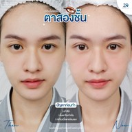 youngdo clinic กรุงเทพ